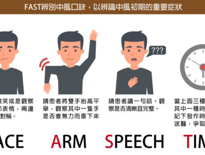 55歲女面無表情，竟是中風警訊？一個笑話救了她一命